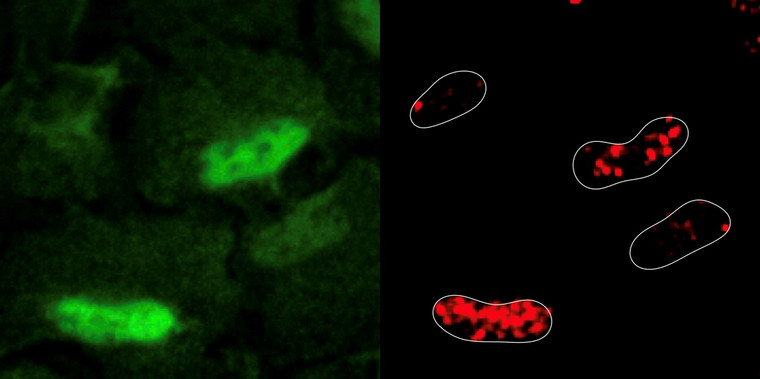 The image illustrates the location of DNA damage (in the nucleus of these four cells – green) and the colocalization of PRDX1 (© Sdelci Lab / CRG).