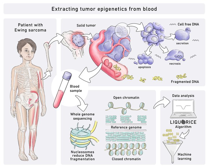 Blood test detects childhood tumors based on their epigenetic profiles Blood test detects childhood tumors based on their epigenetic profiles