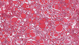 Organs age at different speeds: a blood test might soon tell which ones Organs age at different speeds: a blood test might soon tell which ones