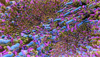 The tumor microbiota: A new frontier in cancer biology The tumor microbiota: A new frontier in cancer biology