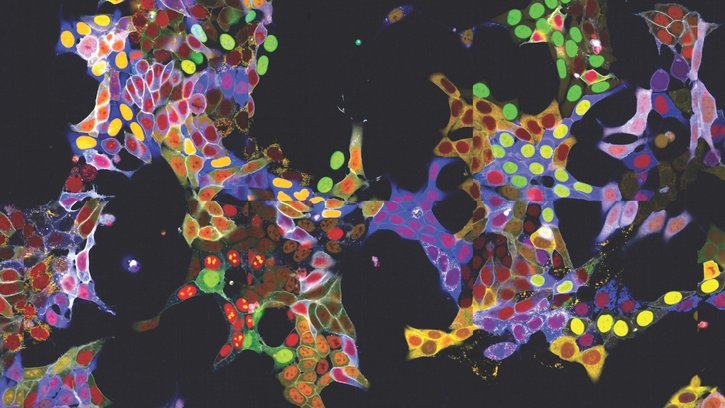 Light Show in Living Cells: New method allows simultaneous fluorescent labelling of many proteins Light Show in Living Cells: New method allows simultaneous fluorescent labelling of many proteins
